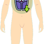 Gubitak kilograma